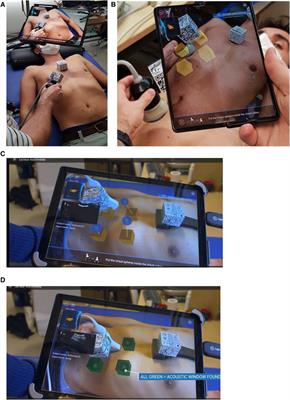 Augmented reality-based software (Echo-QR) for guiding the echographic probe toward the acoustic window: a pilot study